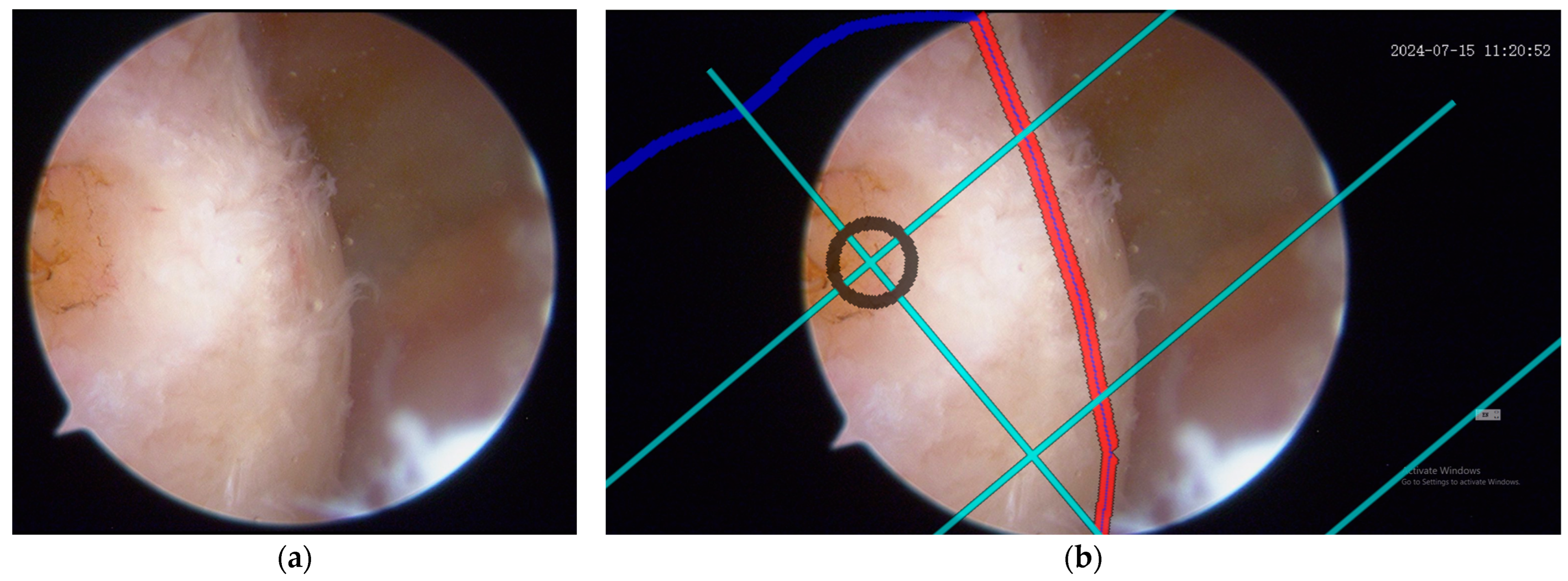 Bioengineering 12 00464 g015