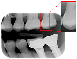 Bioengineering 12 00533 i001