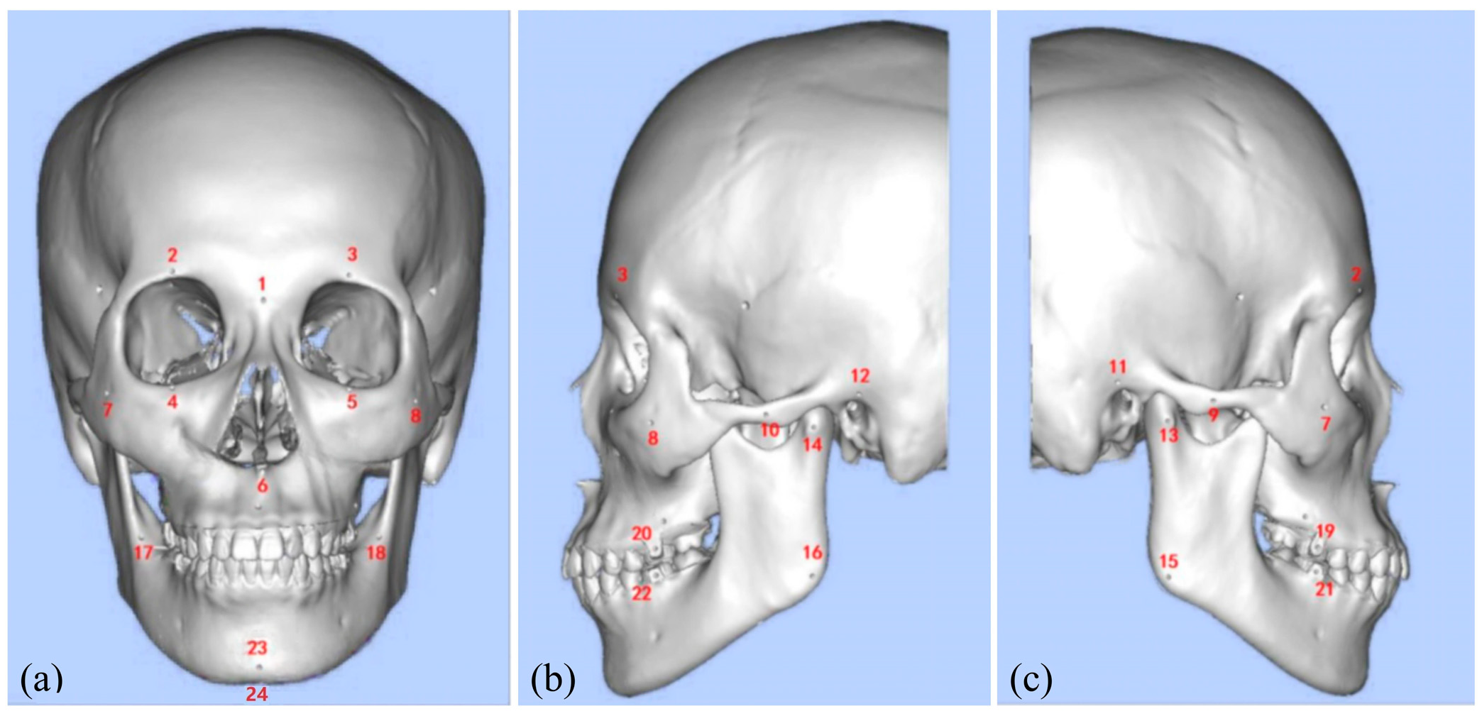 Bioengineering 12 00629 g005