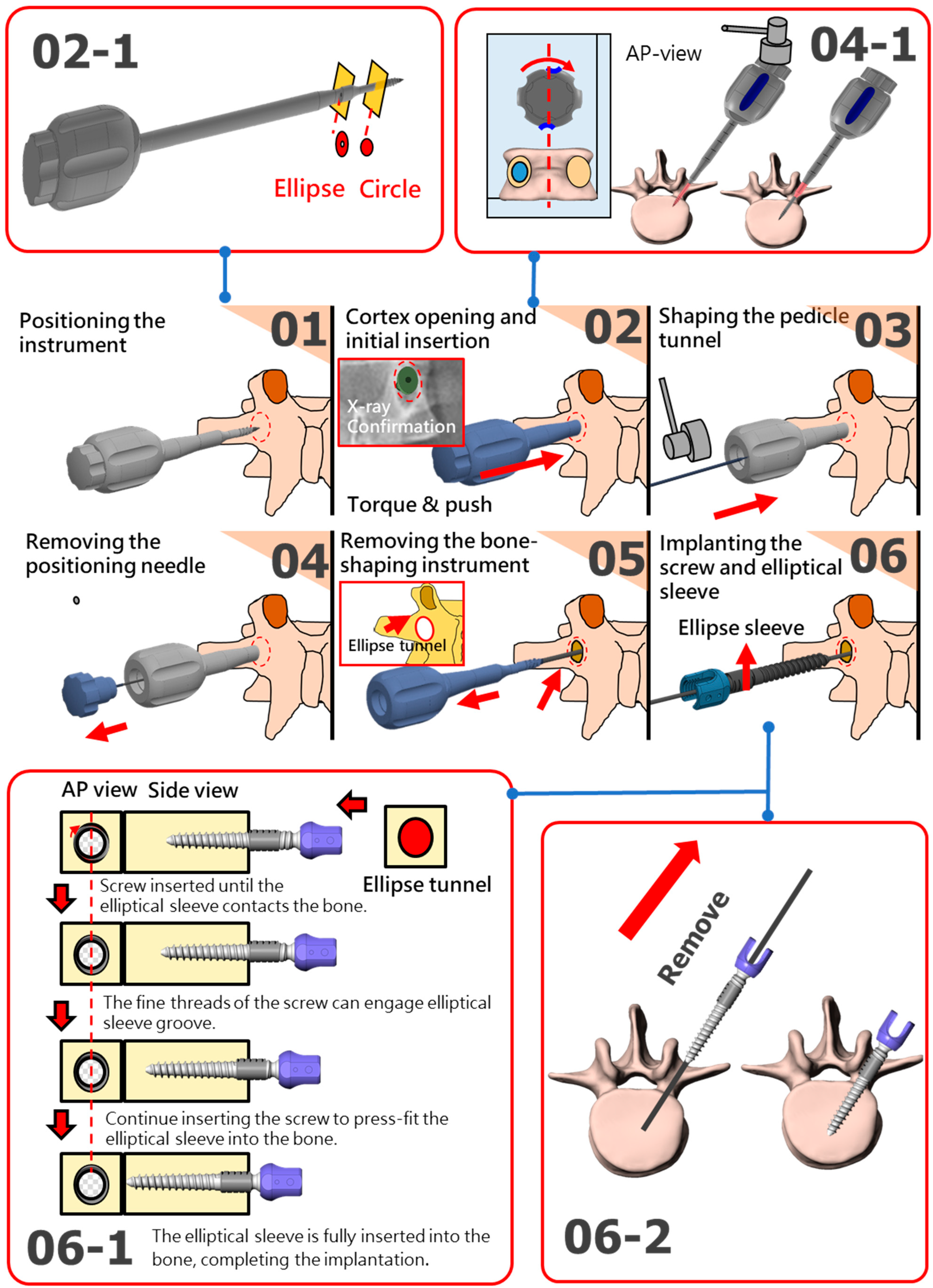 Bioengineering 12 00668 g005