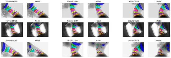 Bioengineering 12 00679 g0a4