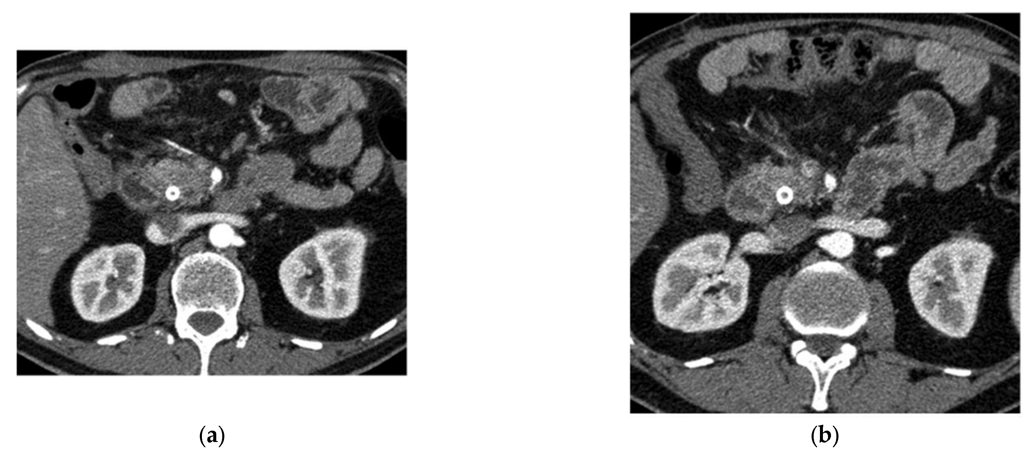 Bioengineering 12 00849 g006