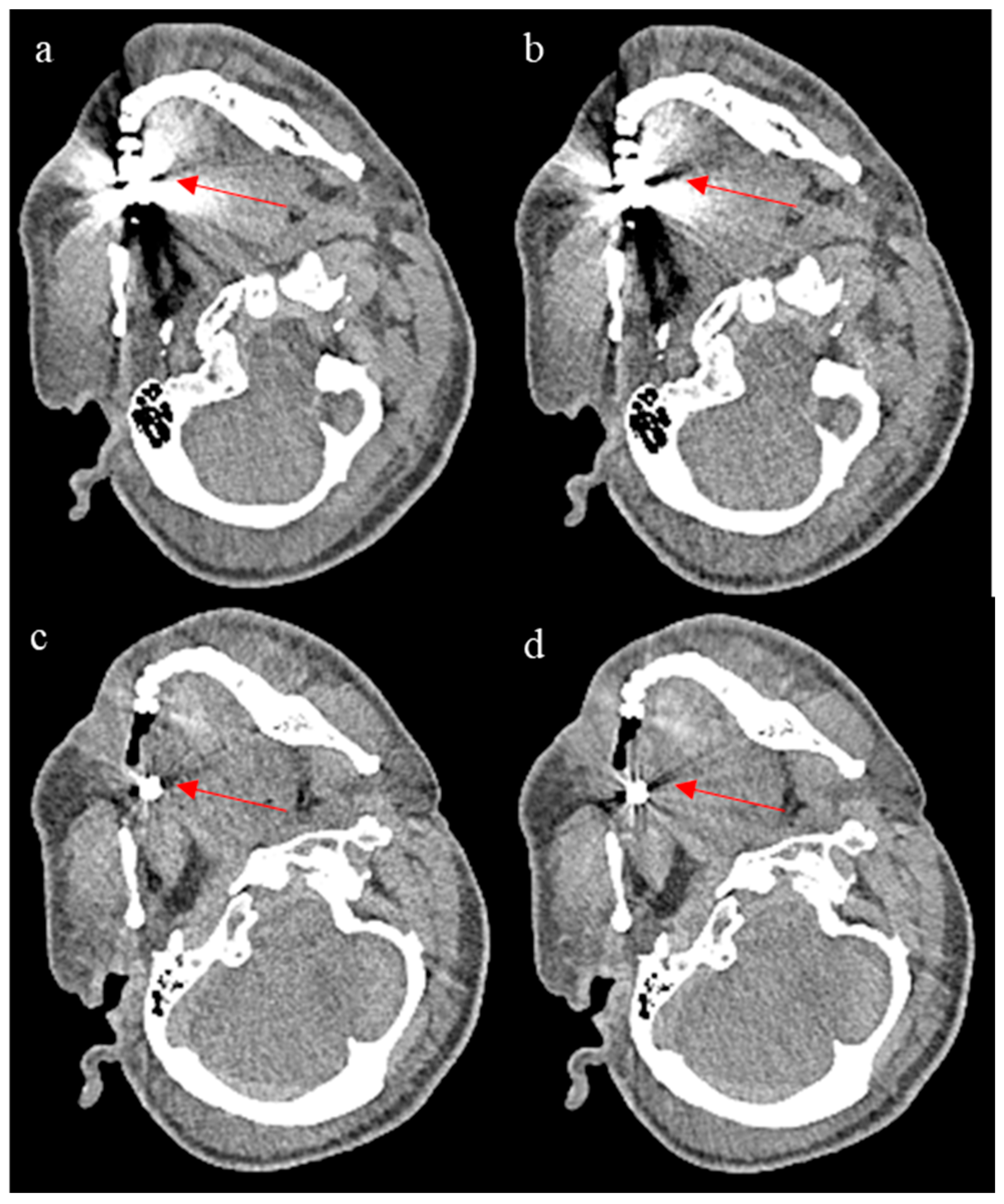 Bioengineering 12 00997 g007