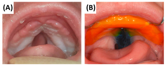 Bioengineering 12 01063 g019