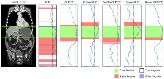 Bioengineering 12 01093 g0a5