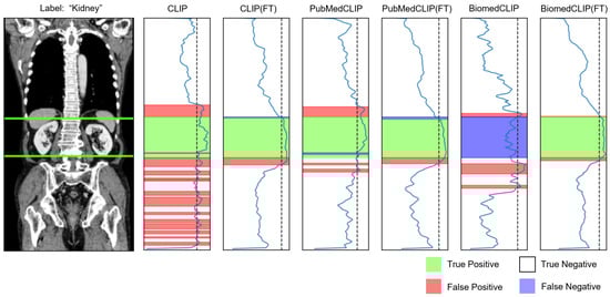 Bioengineering 12 01093 g0a6