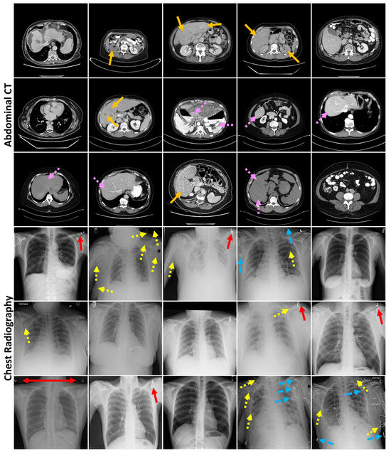 Bioengineering 12 01106 g0a3