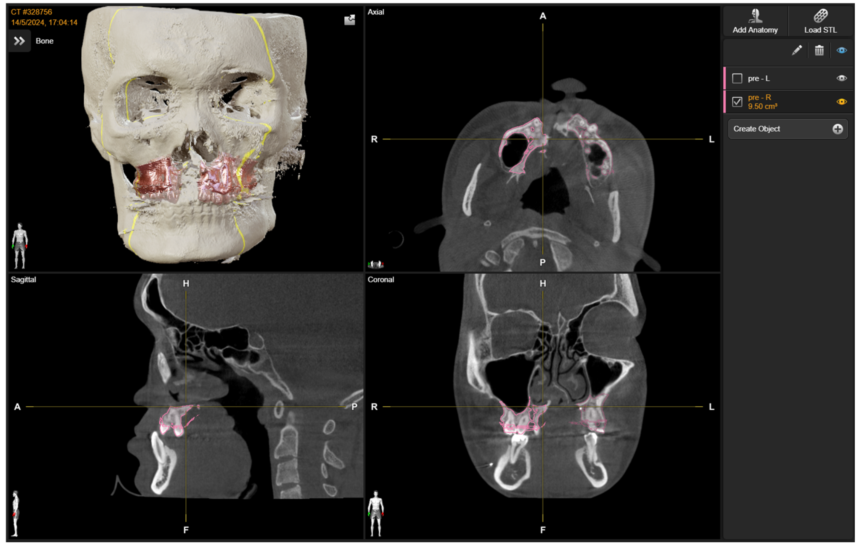 Bioengineering 13 00010 g004