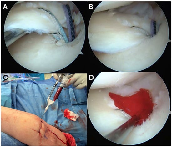 Bioengineering 13 00101 g003