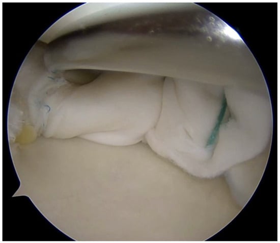 Bioengineering 13 00101 g004