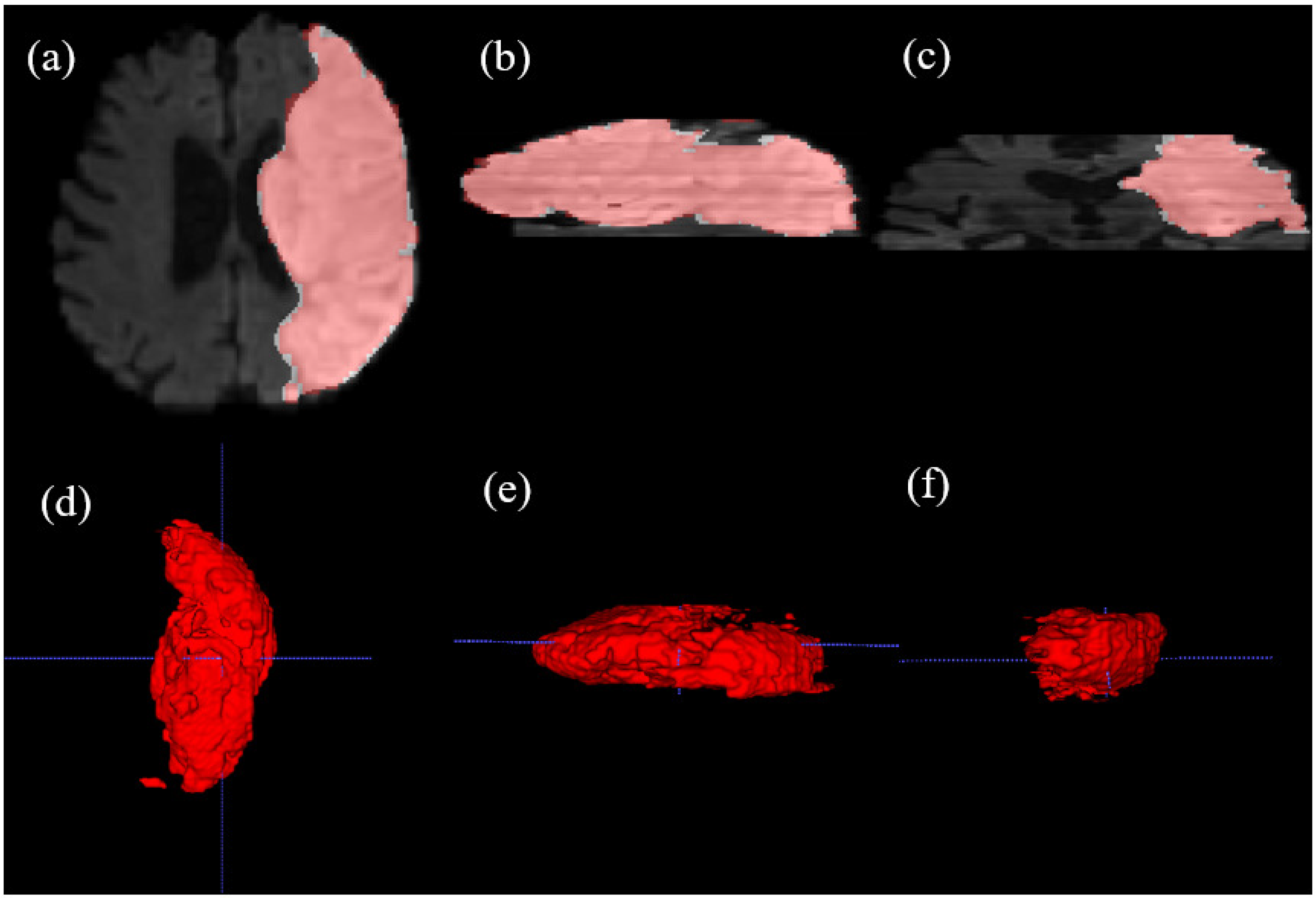 Bioengineering 13 00133 g005