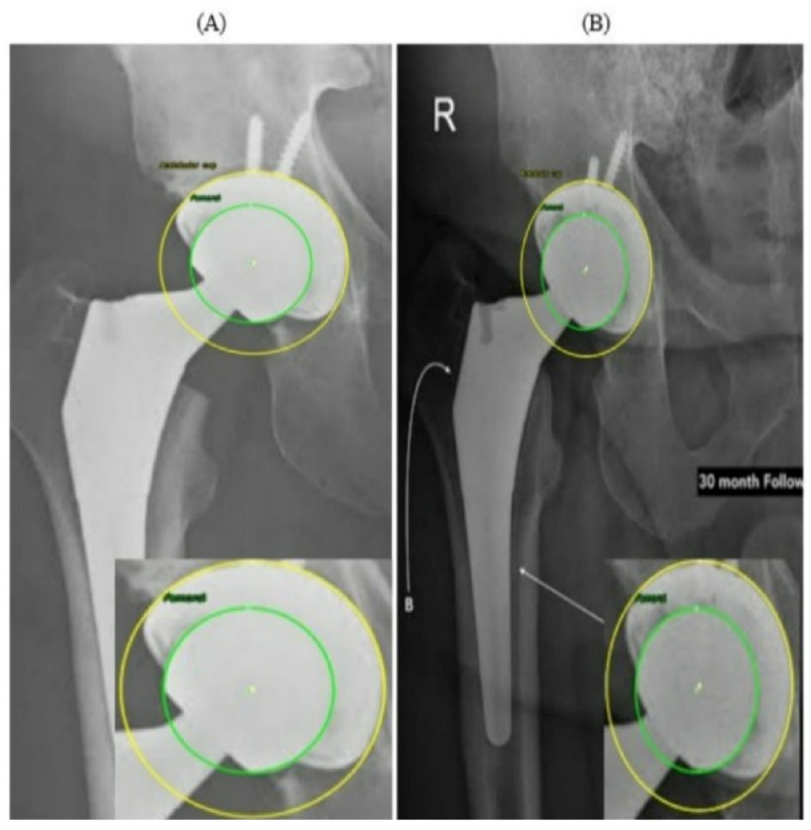 Bioengineering 13 00235 g011