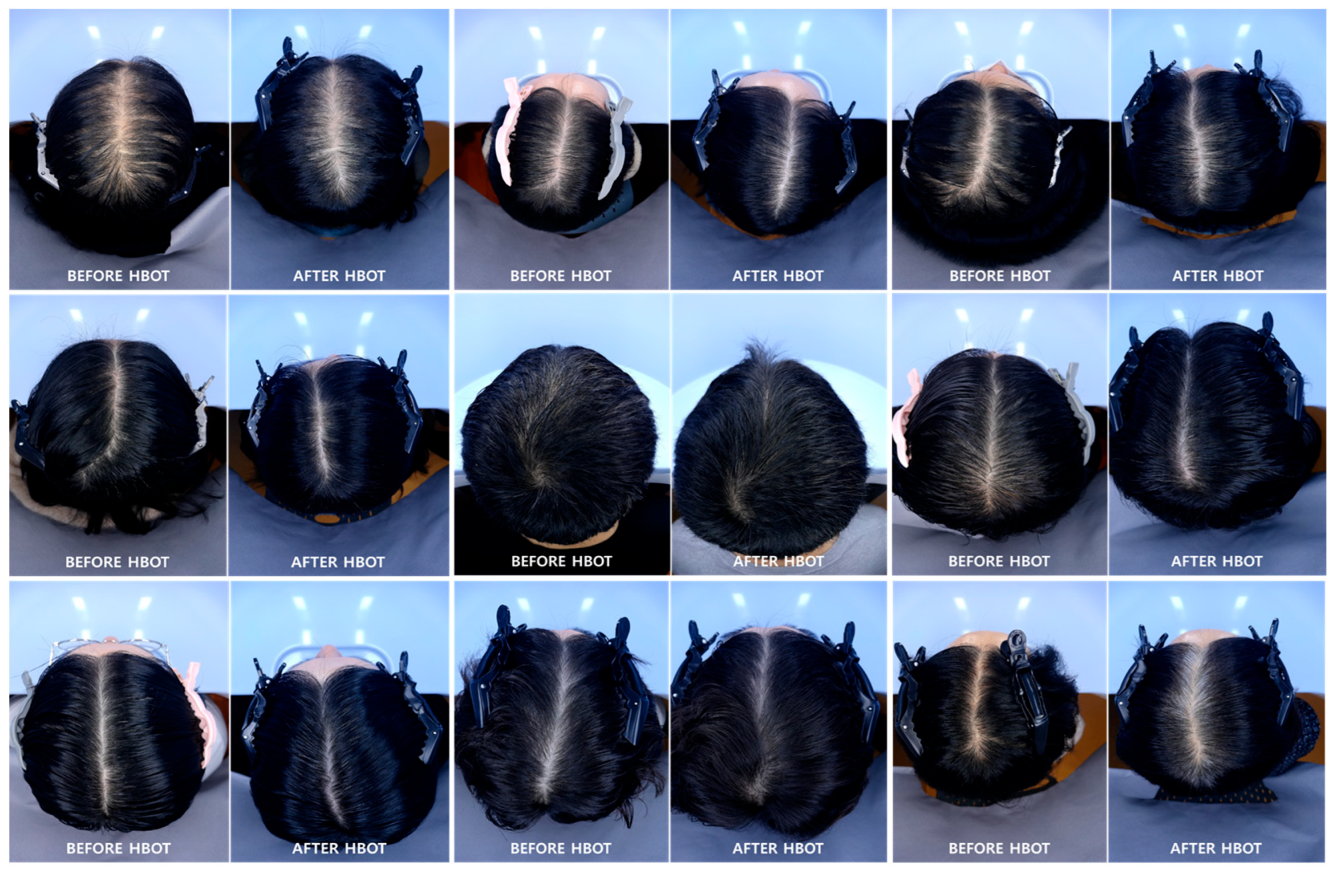 Bioengineering 13 00240 g003 Bioengineering 13 00240 g003