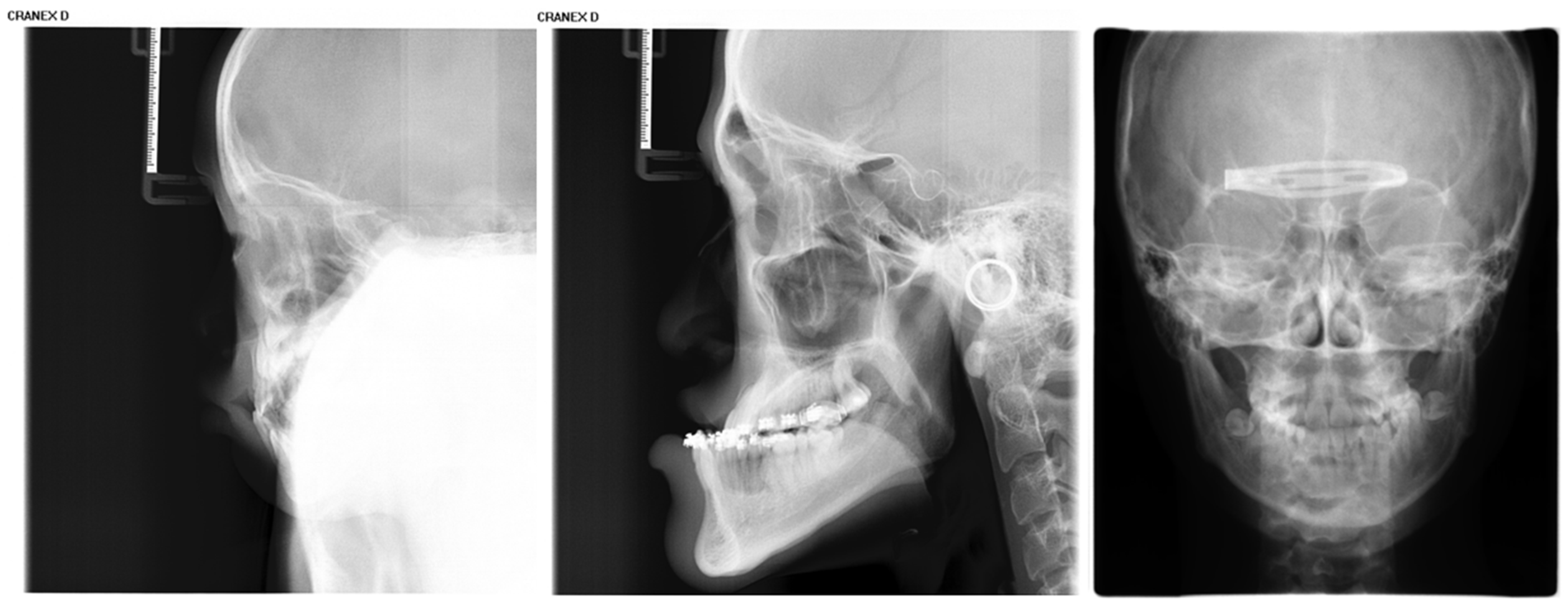 Bioengineering 13 00277 g003