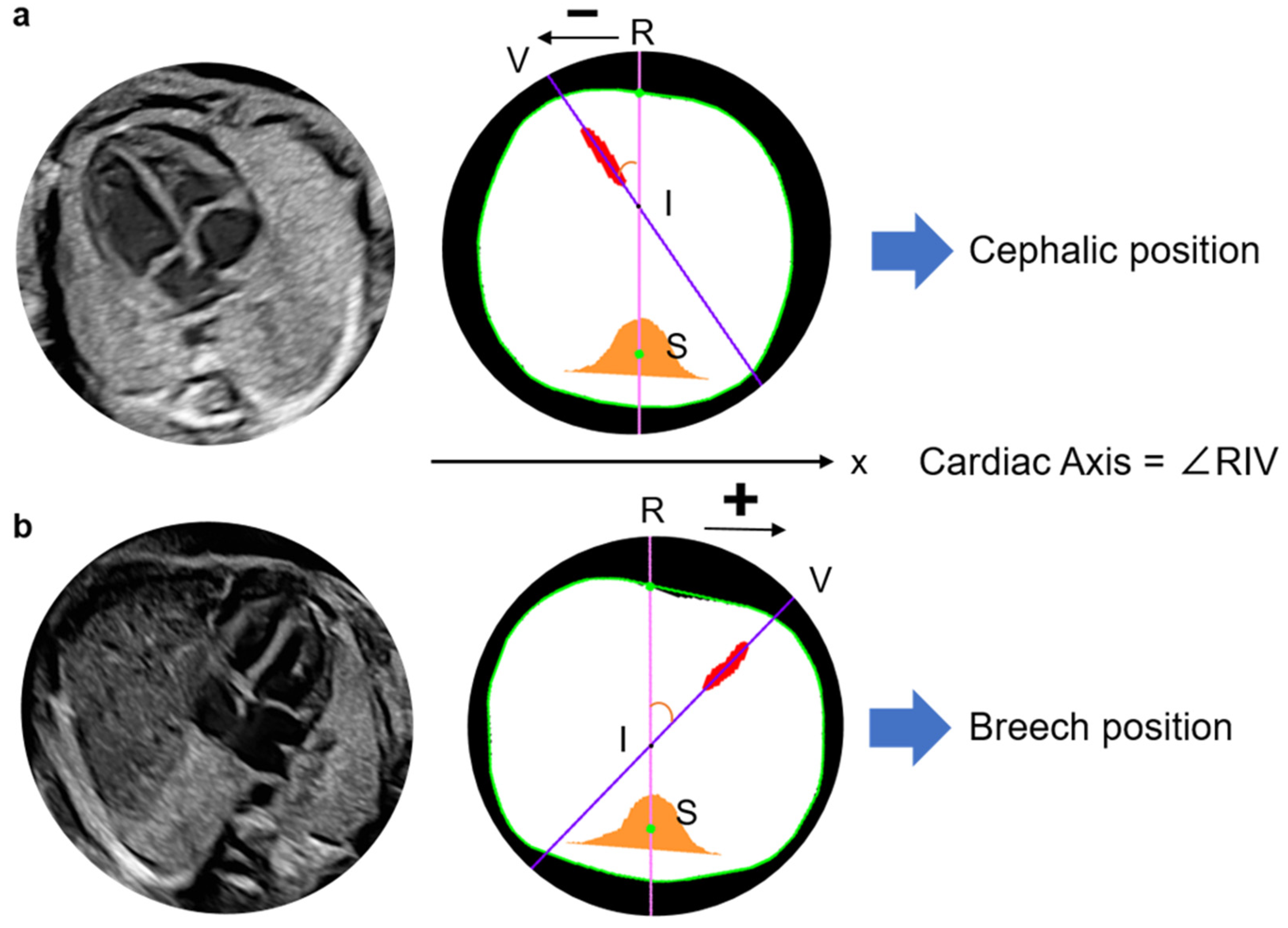 Bioengineering 13 00303 g002