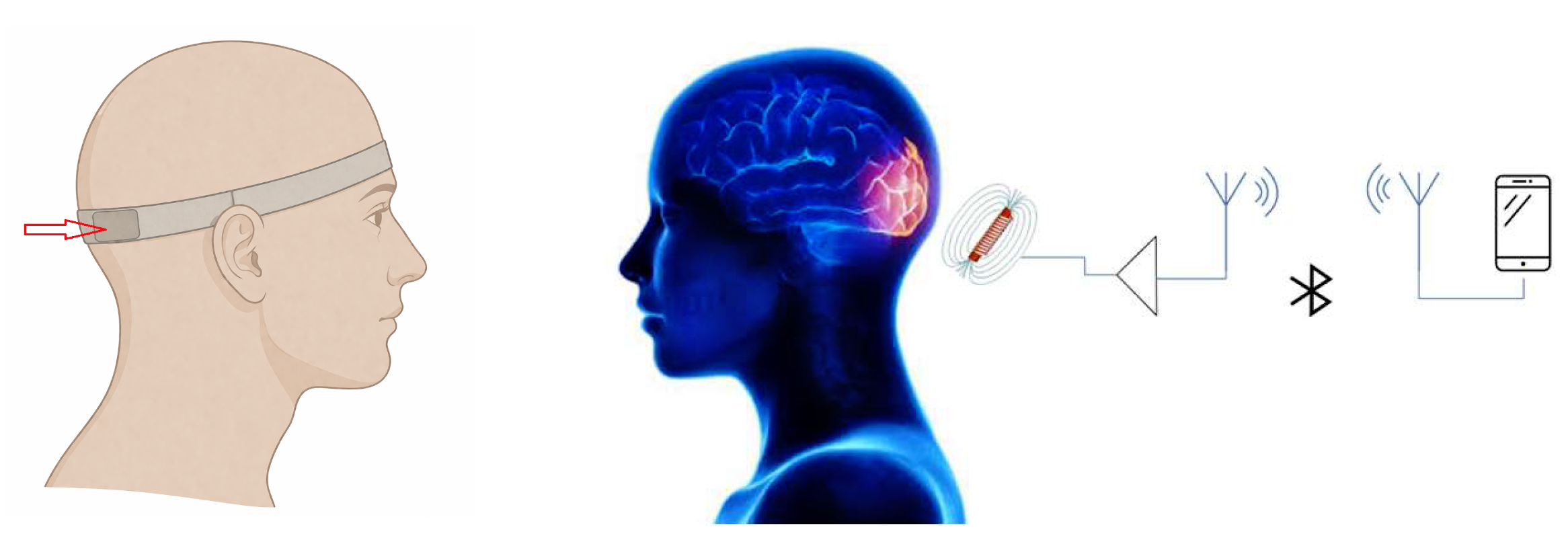 Bioengineering 13 00395 g001 Bioengineering 13 00395 g001