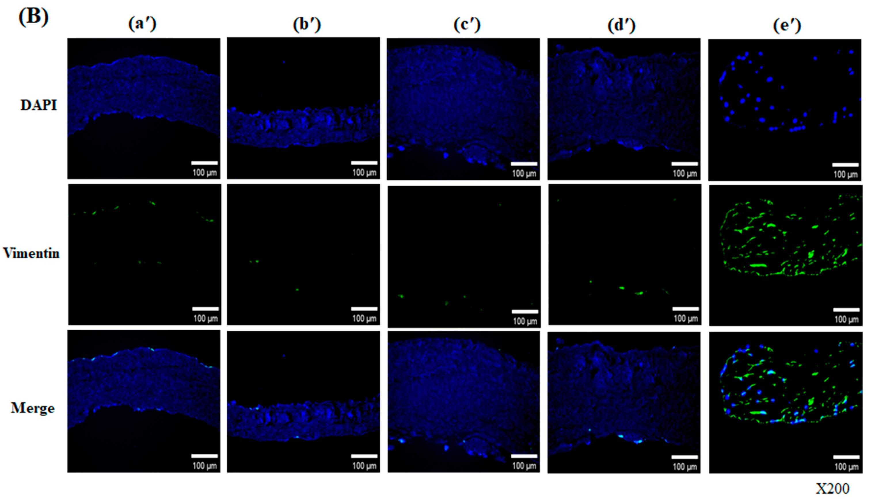 Bioengineering 13 00546 g003b Bioengineering 13 00546 g003b