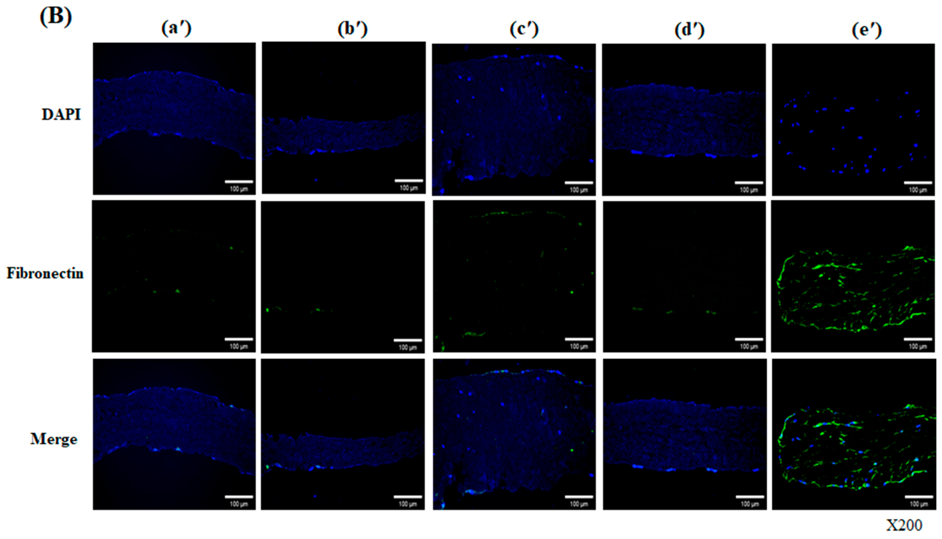 Bioengineering 13 00546 g004b Bioengineering 13 00546 g004b