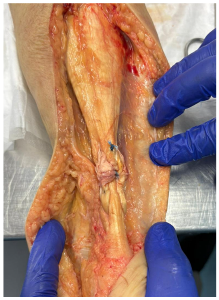Bioengineering 13 00594 g003 Bioengineering 13 00594 g003