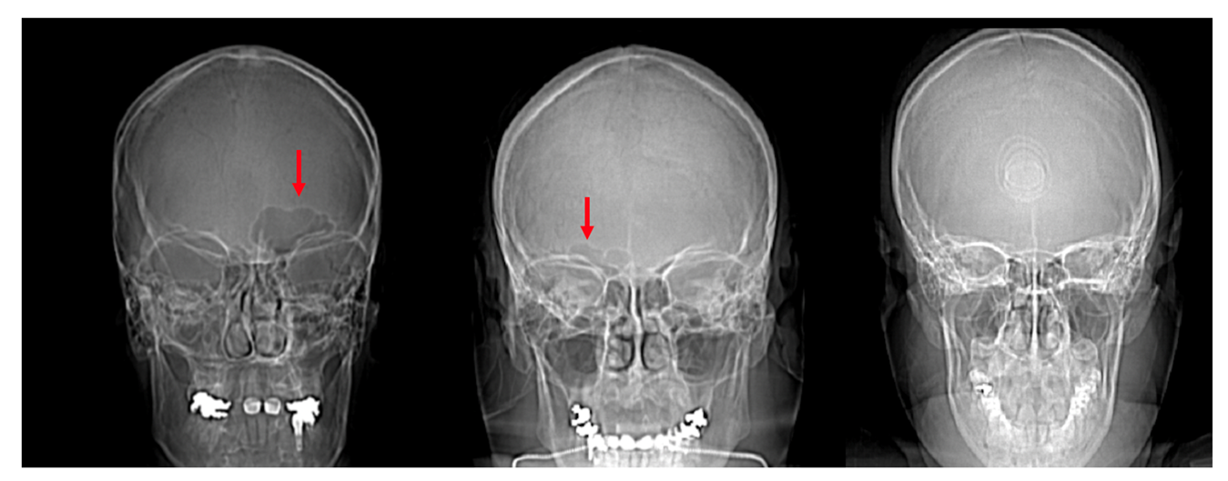 Biology 11 01145 g006