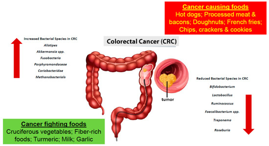 The Pivotal Role of the Gut Microbiome in Colorectal Cancer | MDPI