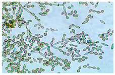 Biology 14 00911 i003