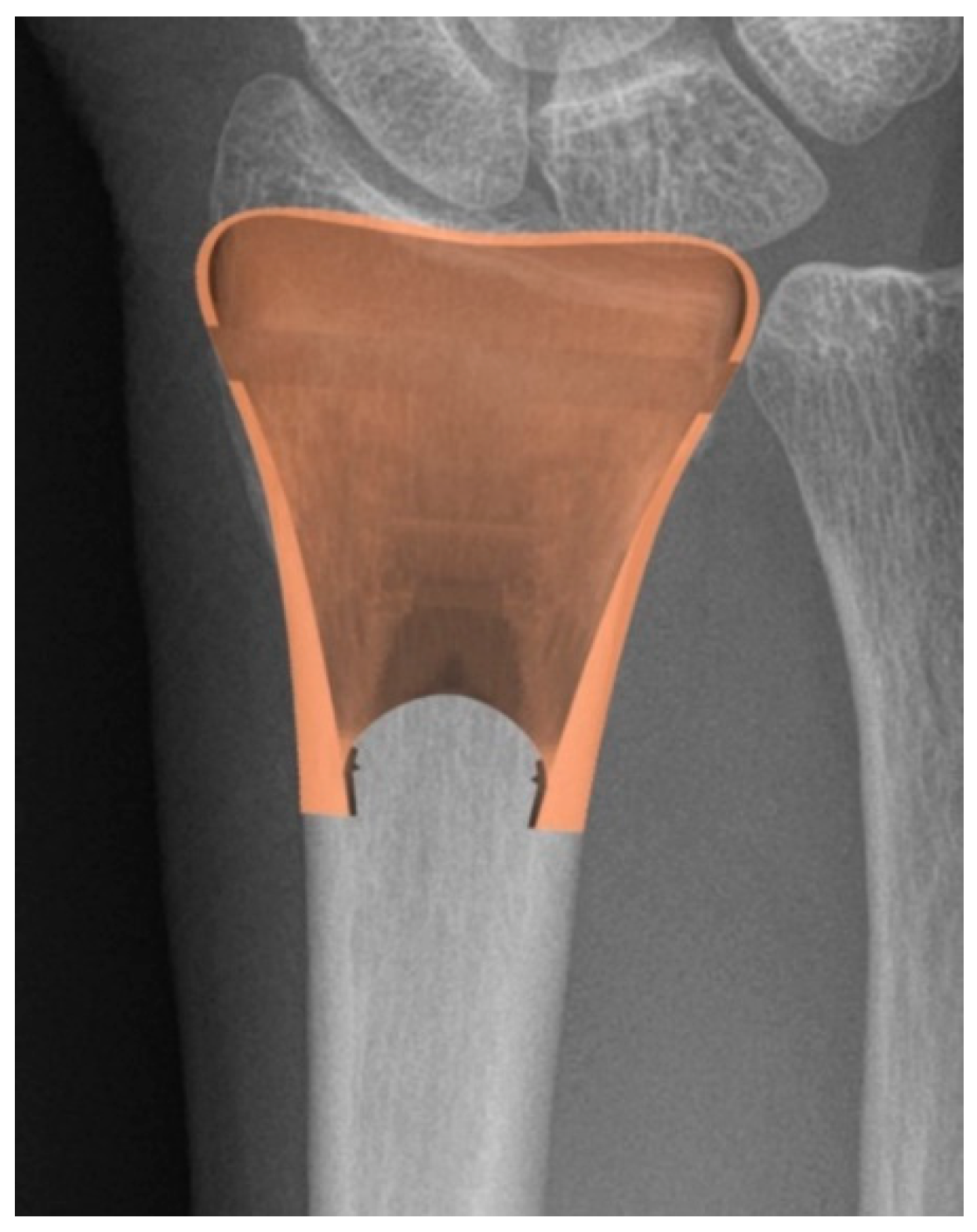 Biomechanics 01 00003 g002 Biomechanics 01 00003 g002