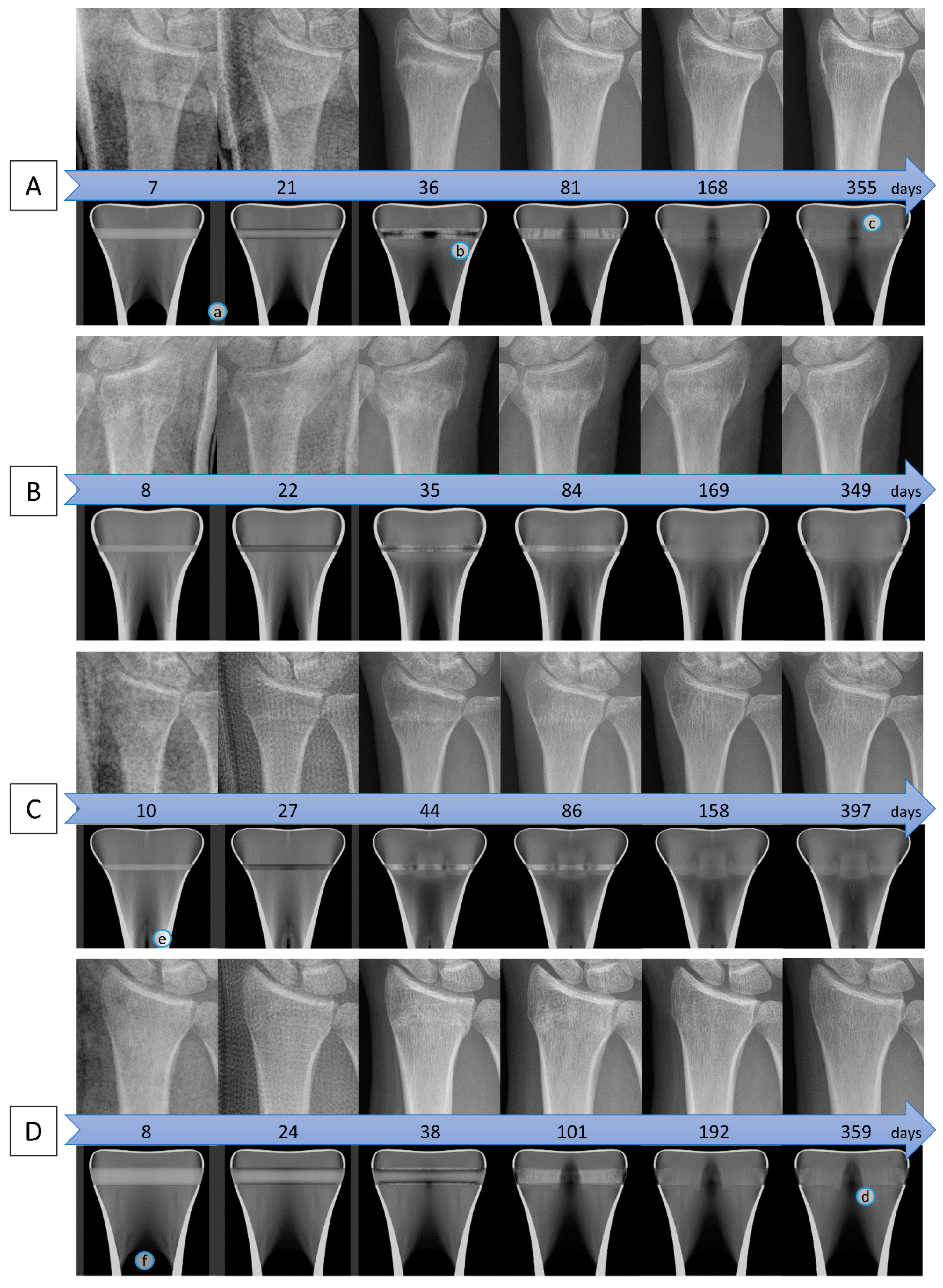 Biomechanics 01 00003 g004 Biomechanics 01 00003 g004