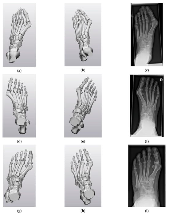 Biomechanics 03 00042 g0a1