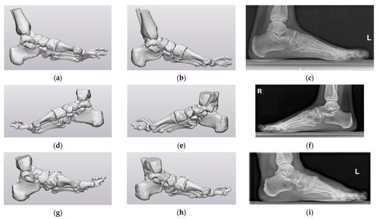 Biomechanics 03 00042 g0a2