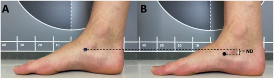 Biomechanics 04 00039 g001