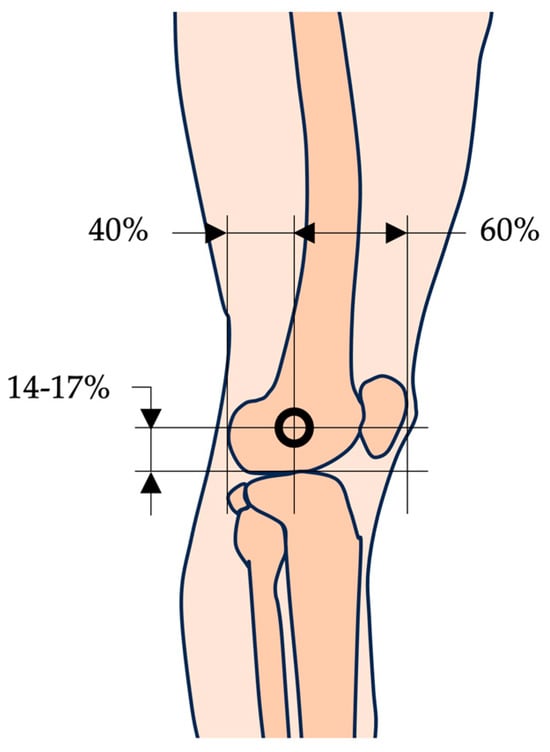 Pivot point of the tibiofemoral joint determination [41].