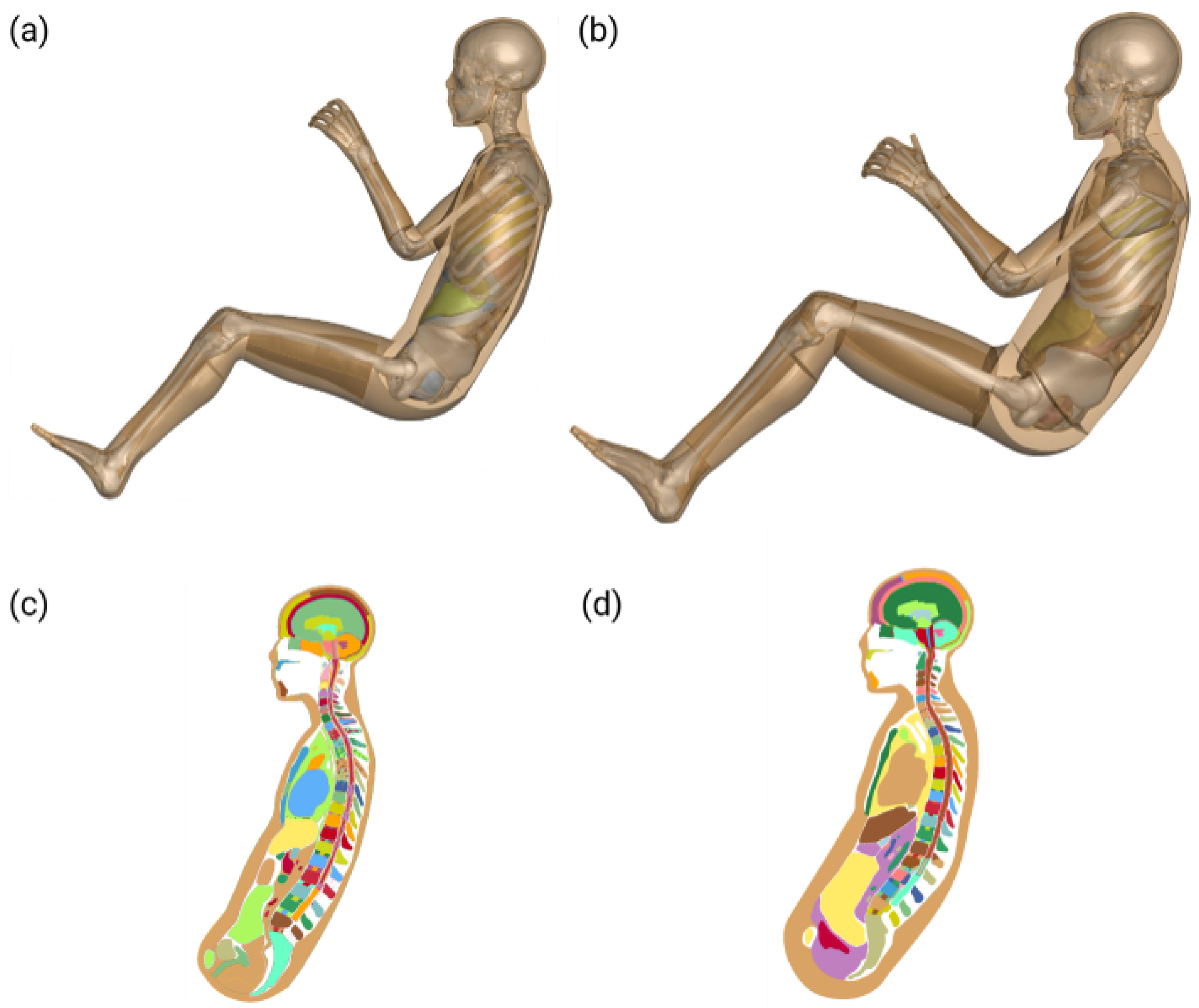Biomechanics 06 00037 g012