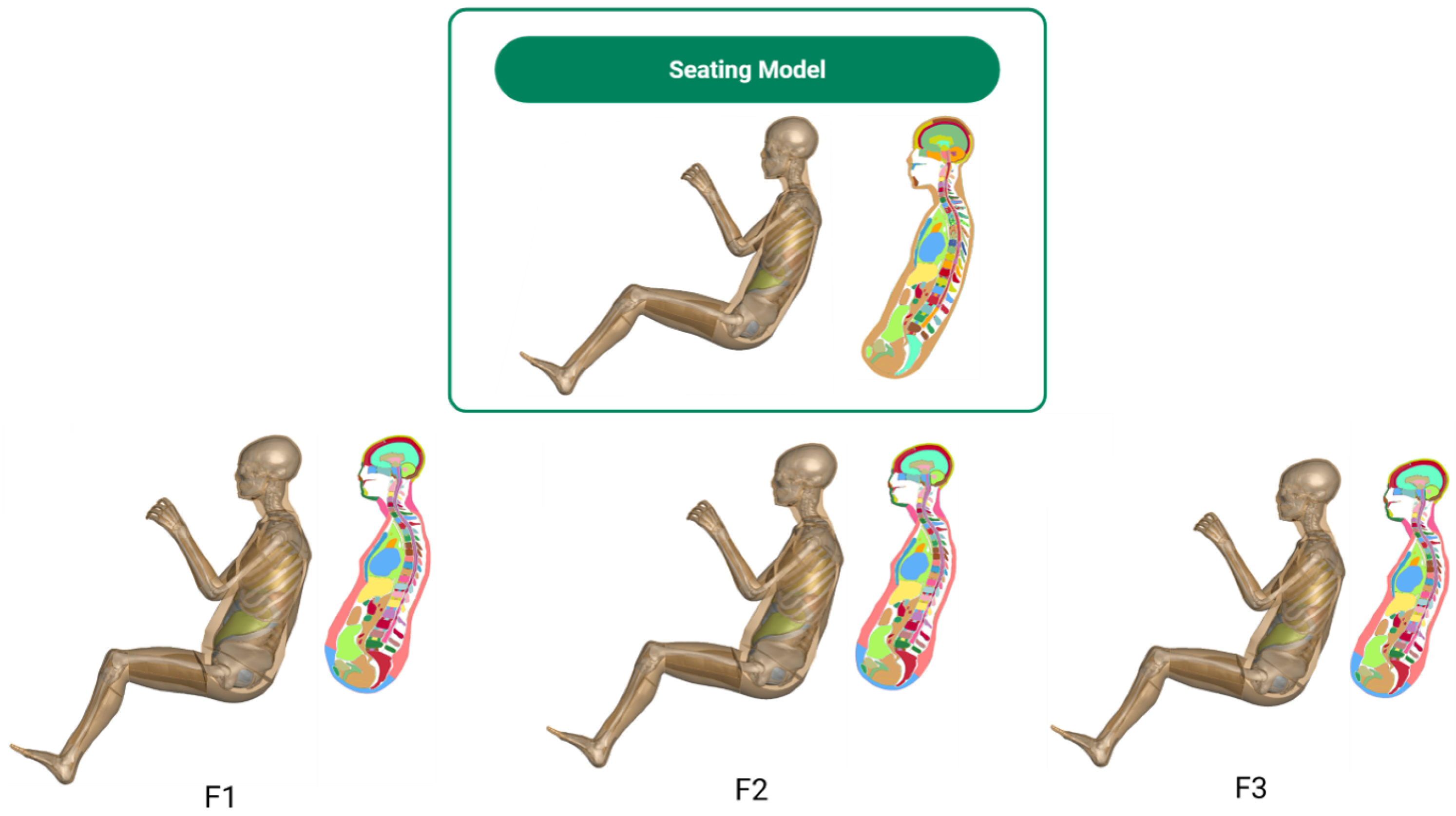 Biomechanics 06 00037 g014
