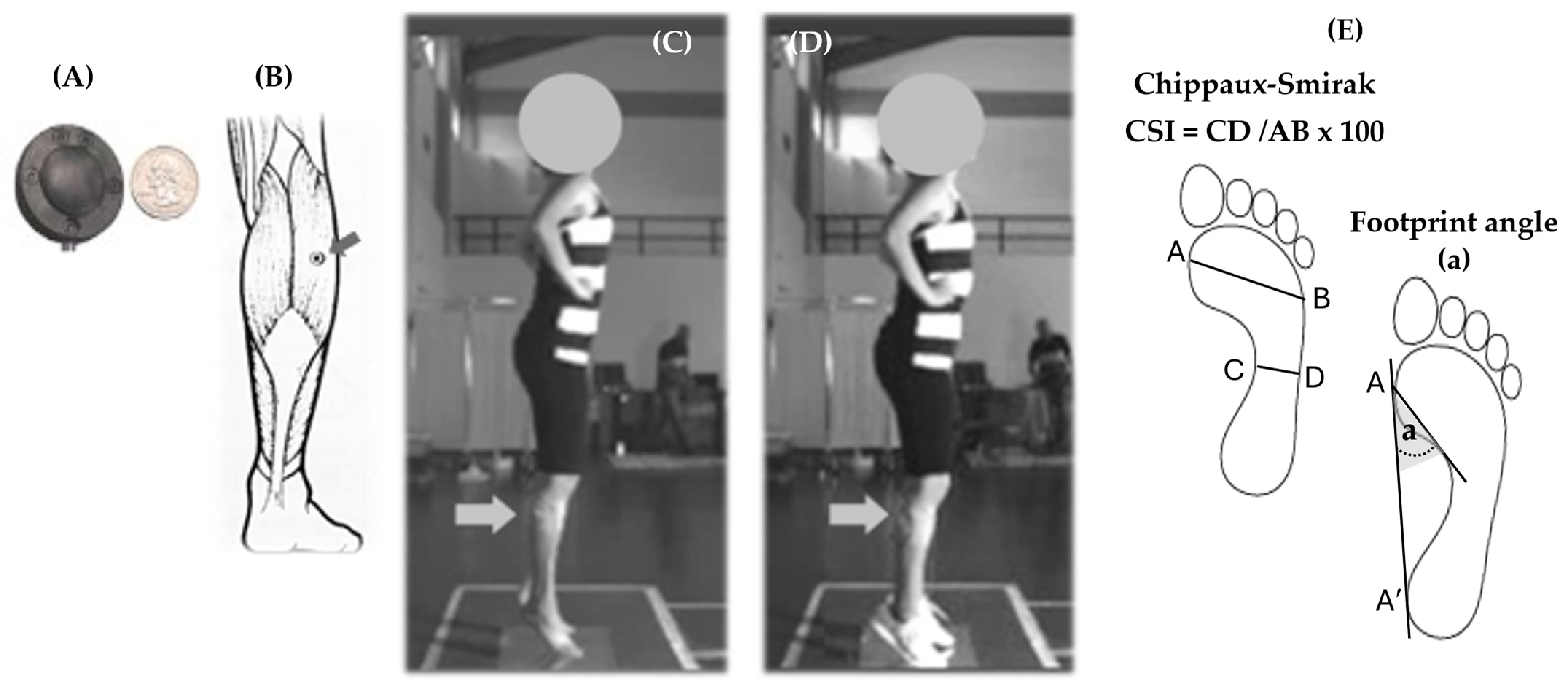 Biomechanics 06 00060 g001 Biomechanics 06 00060 g001