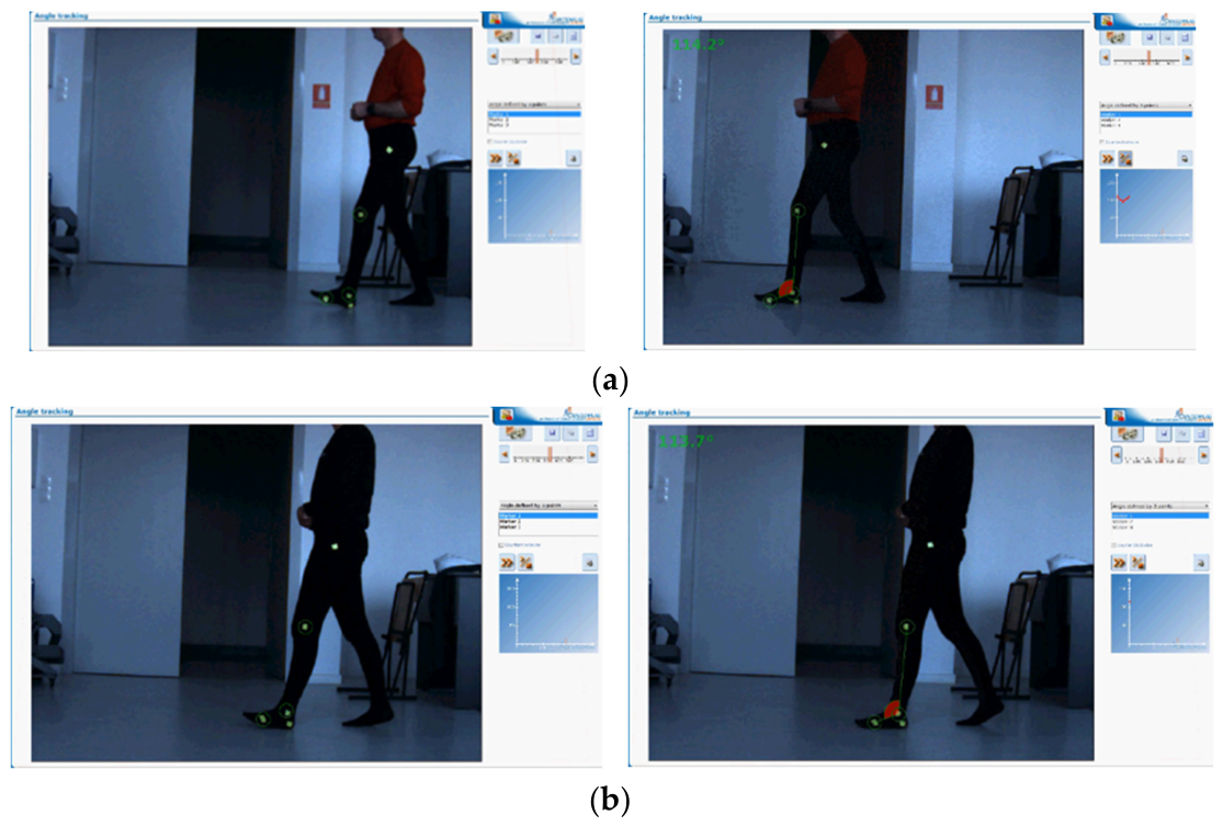 Biomechanics 06 00072 g006