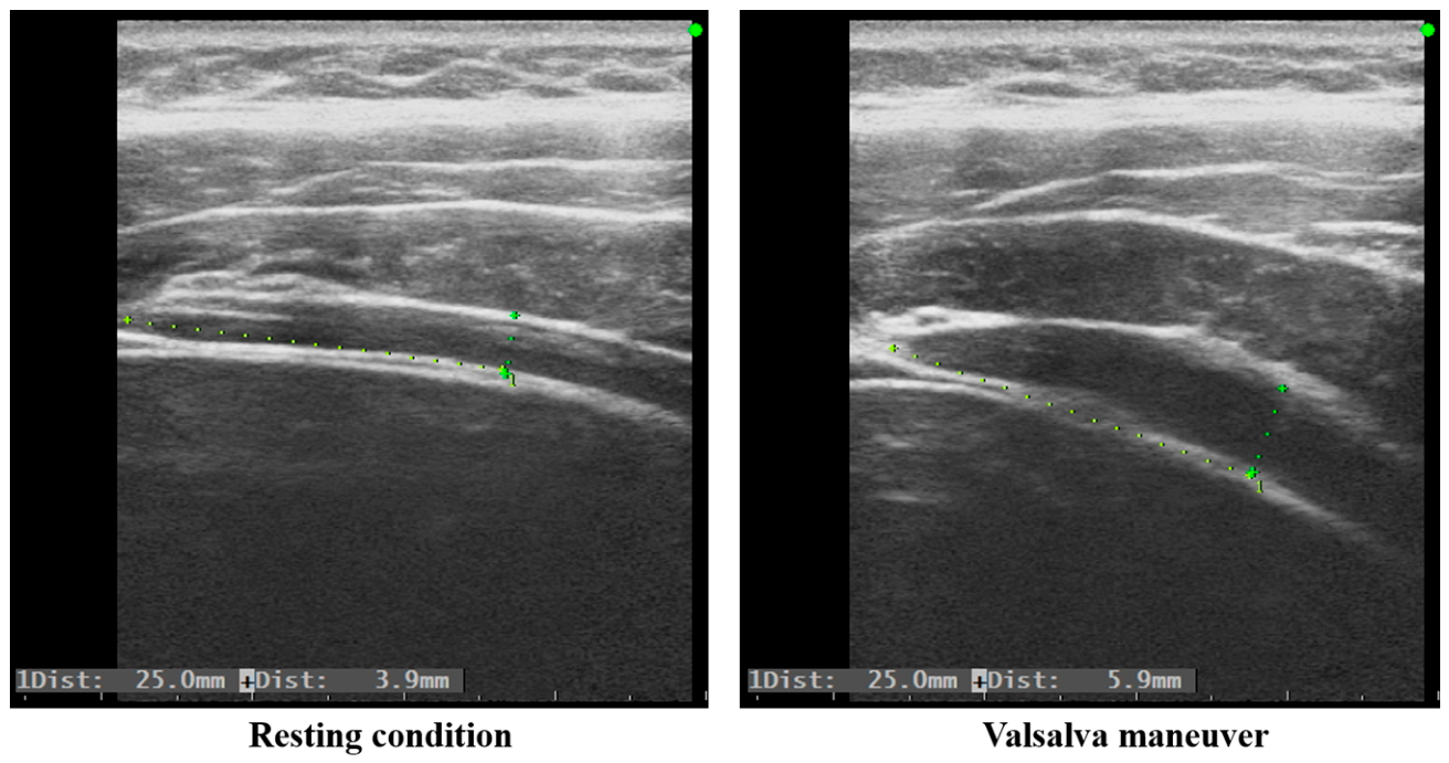 Biomechanics 06 00079 g002 Biomechanics 06 00079 g002