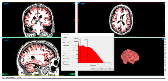 Biomed 04 00034 g007