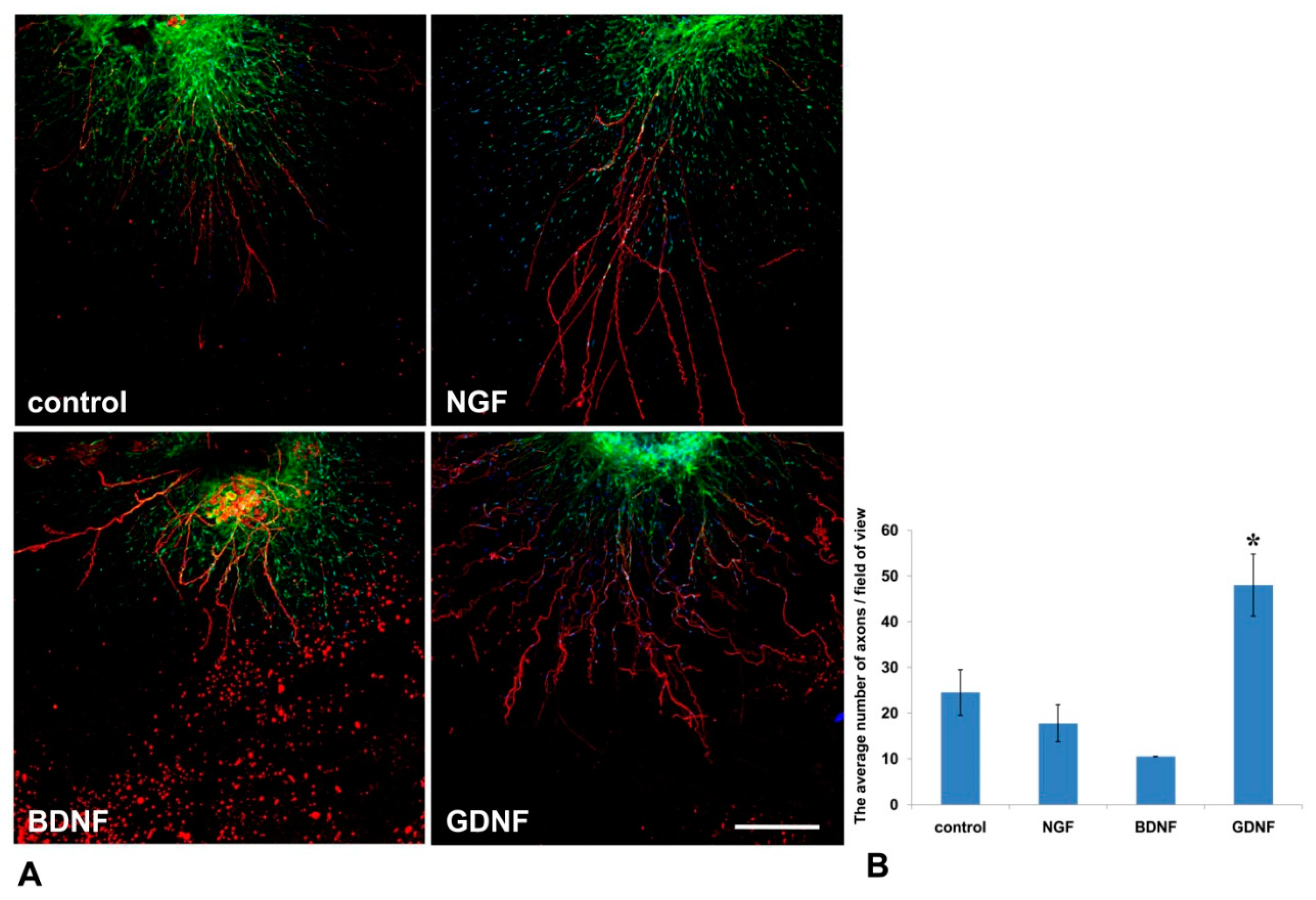 Biomedicines 08 00049 g005
