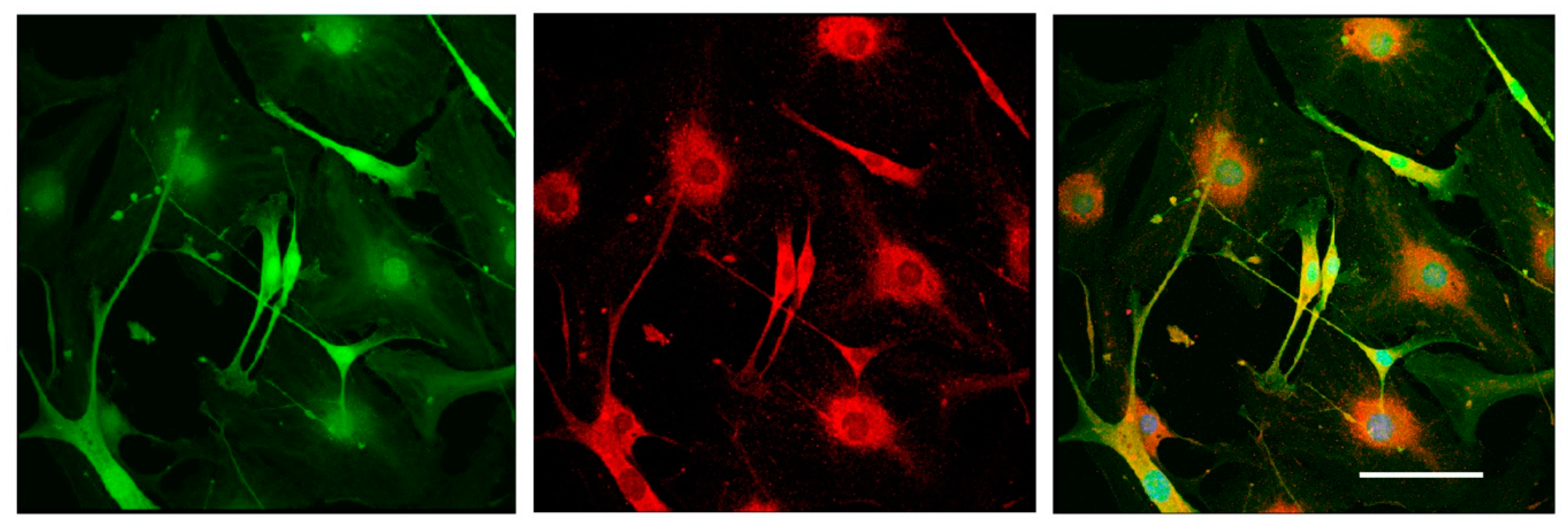 Biomedicines 08 00049 g007