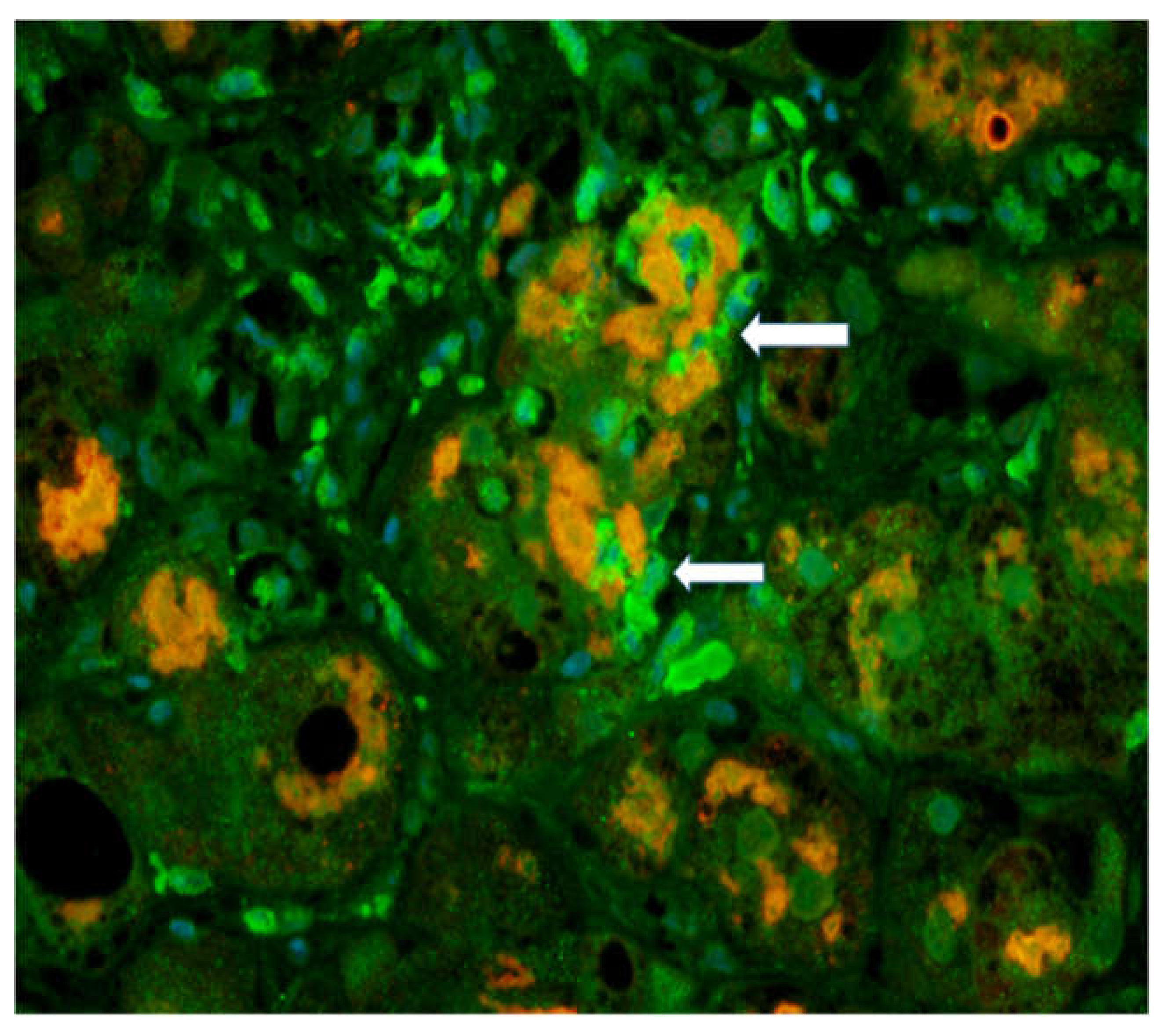 Biomedicines 08 00063 g001
