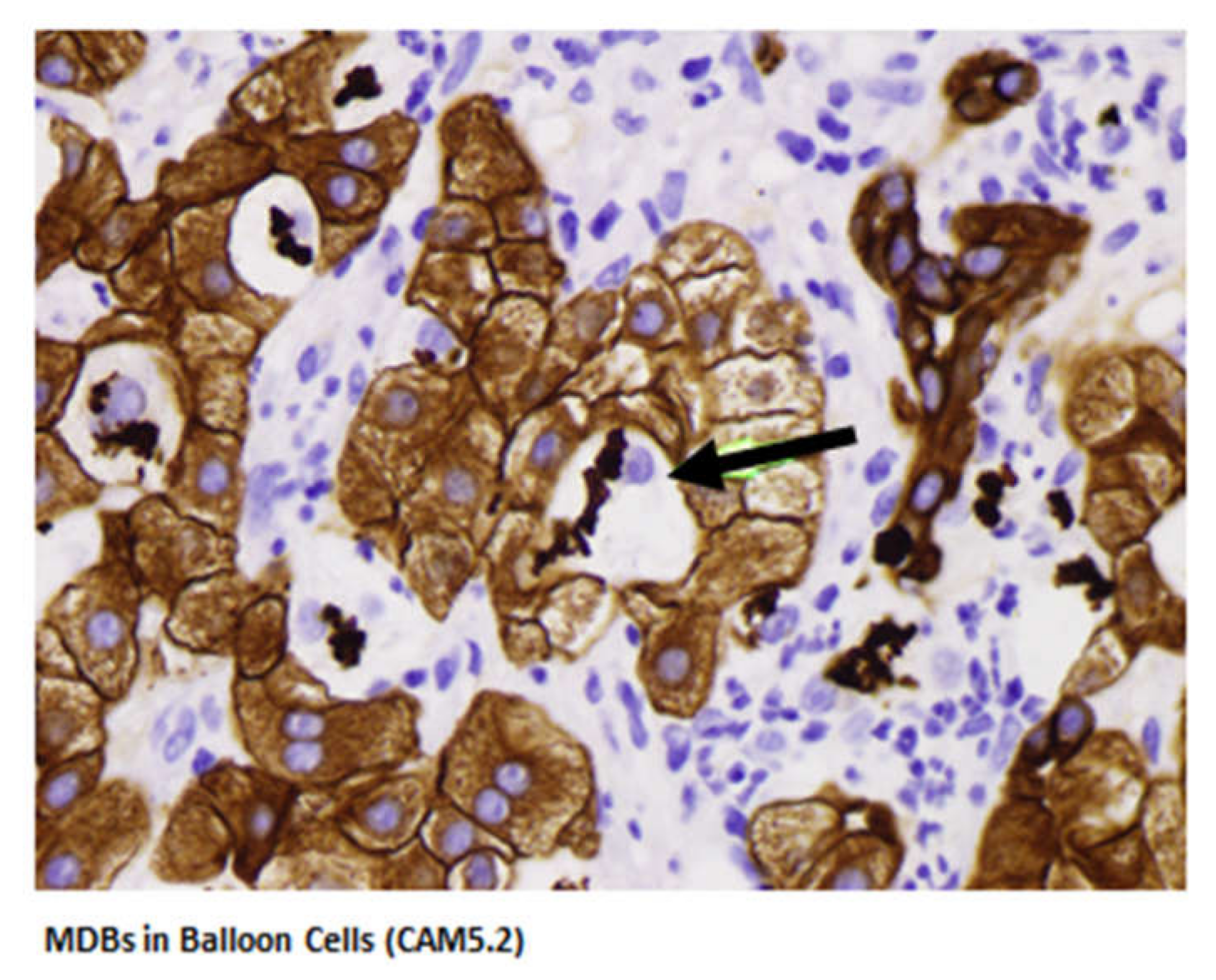 Biomedicines 08 00063 g003