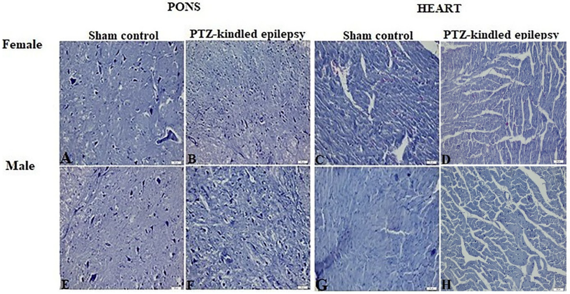 Biomedicines 08 00113 g003