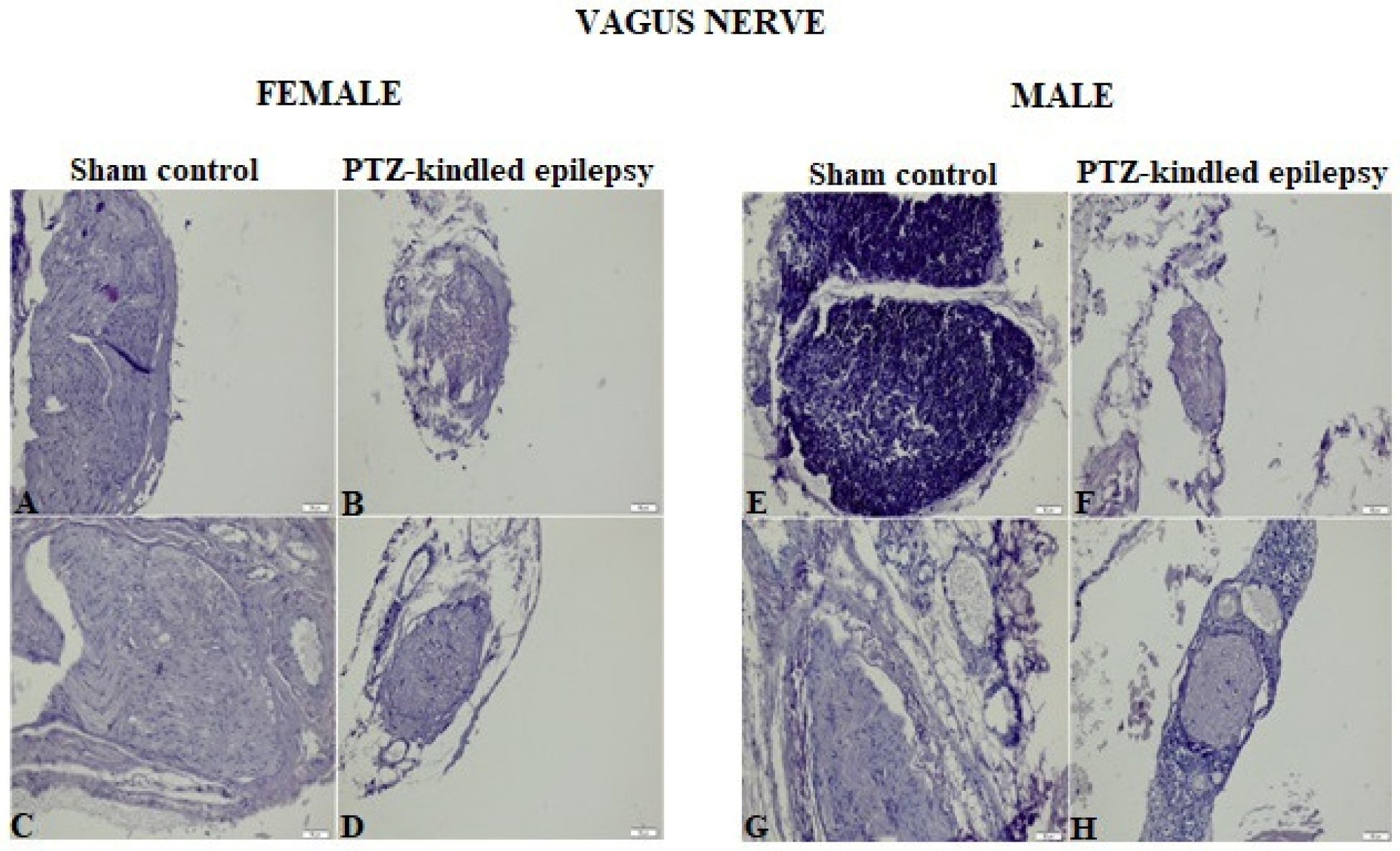 Biomedicines 08 00113 g004