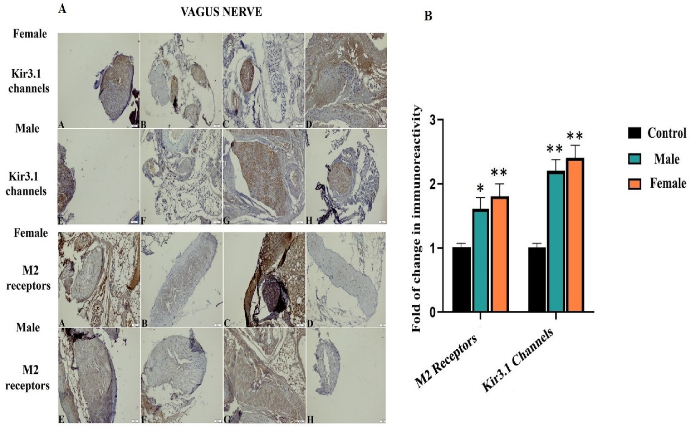 Biomedicines 08 00113 g006