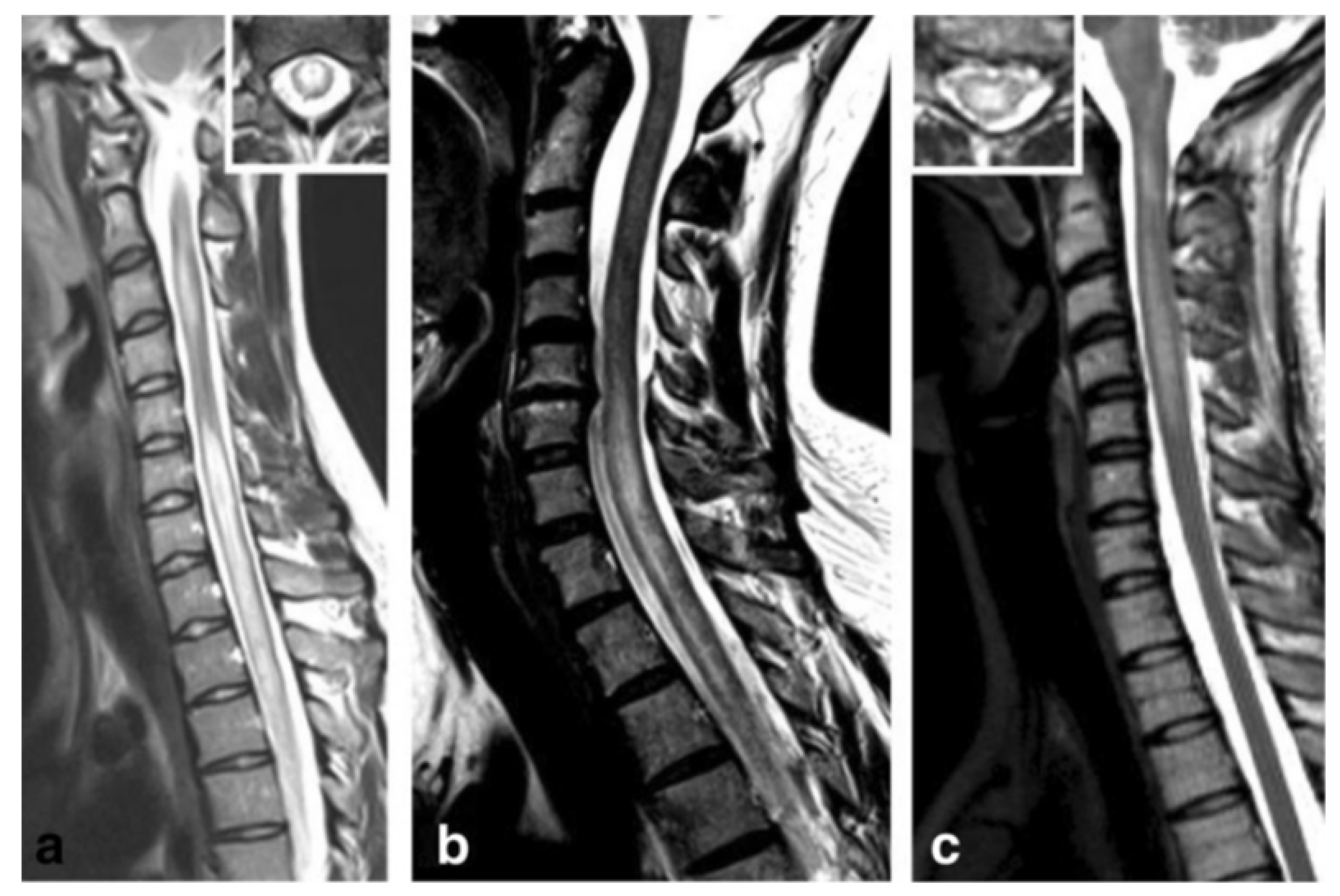 Biomedicines 08 00130 g003 Biomedicines 08 00130 g003