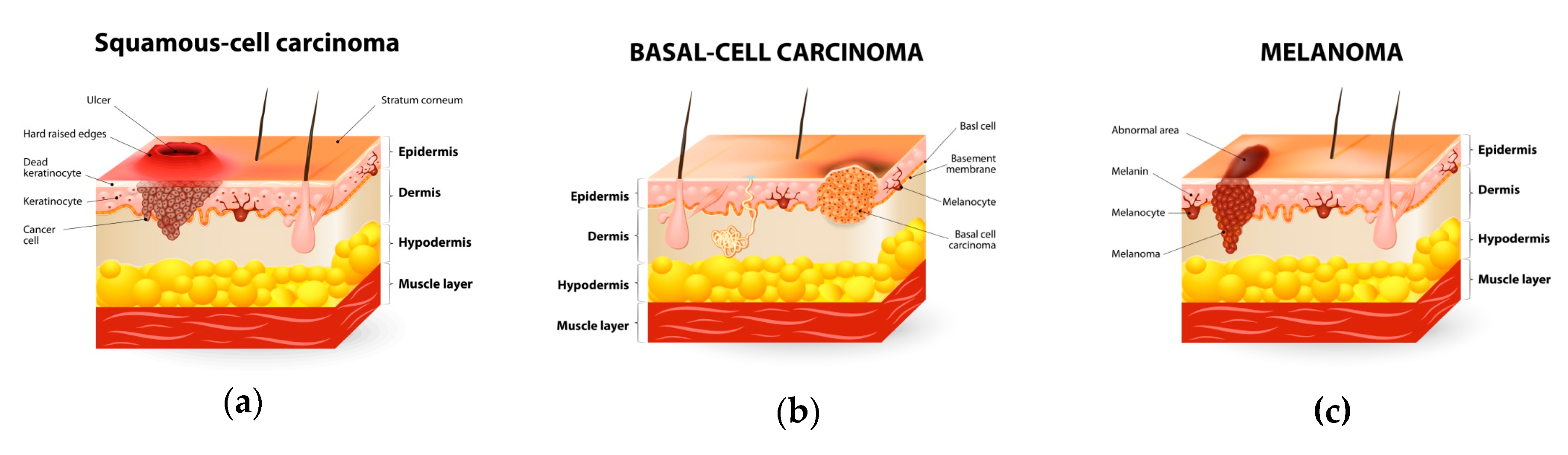 Biomedicines 08 00336 g004