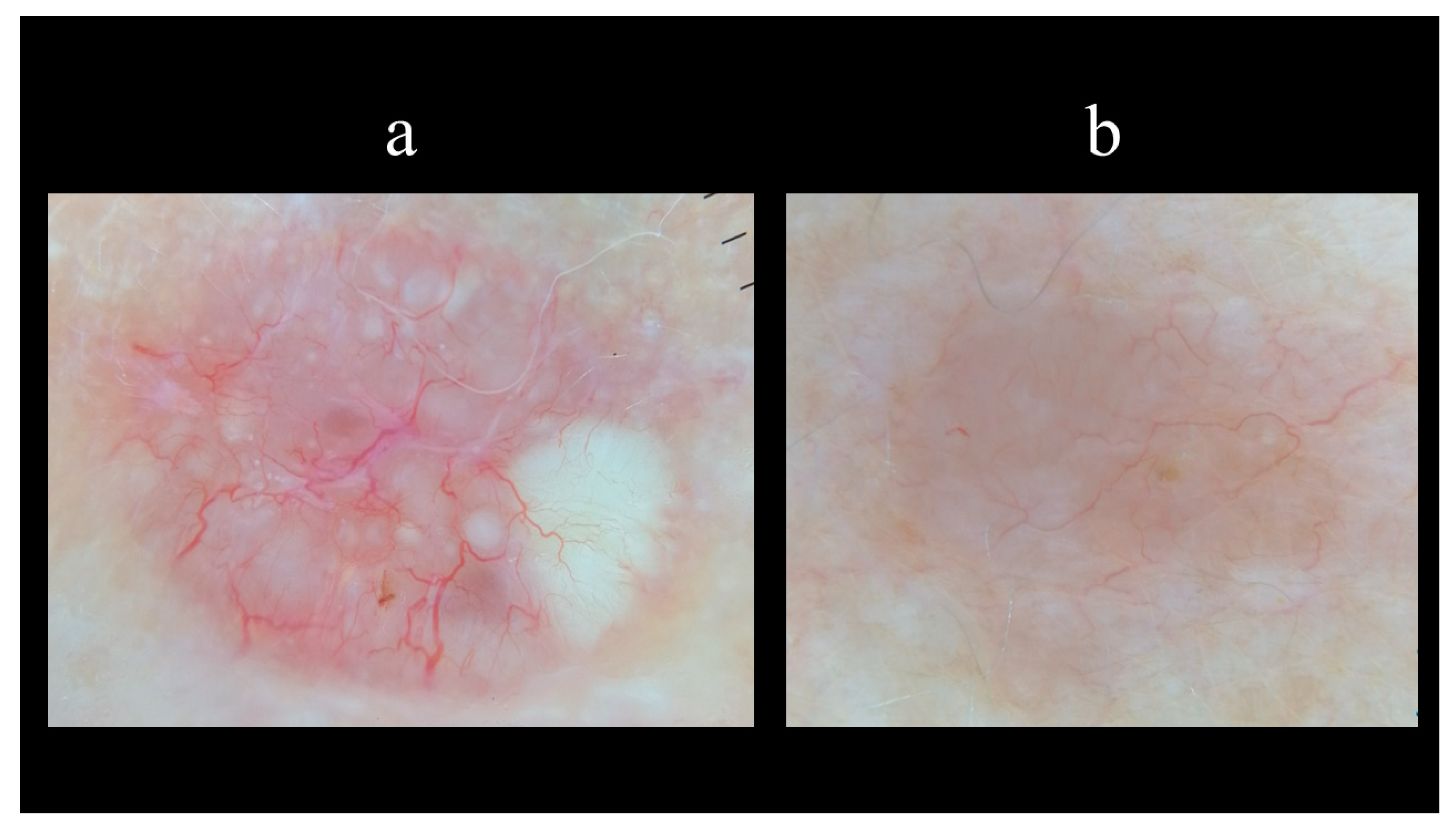 Biomedicines 08 00449 g010