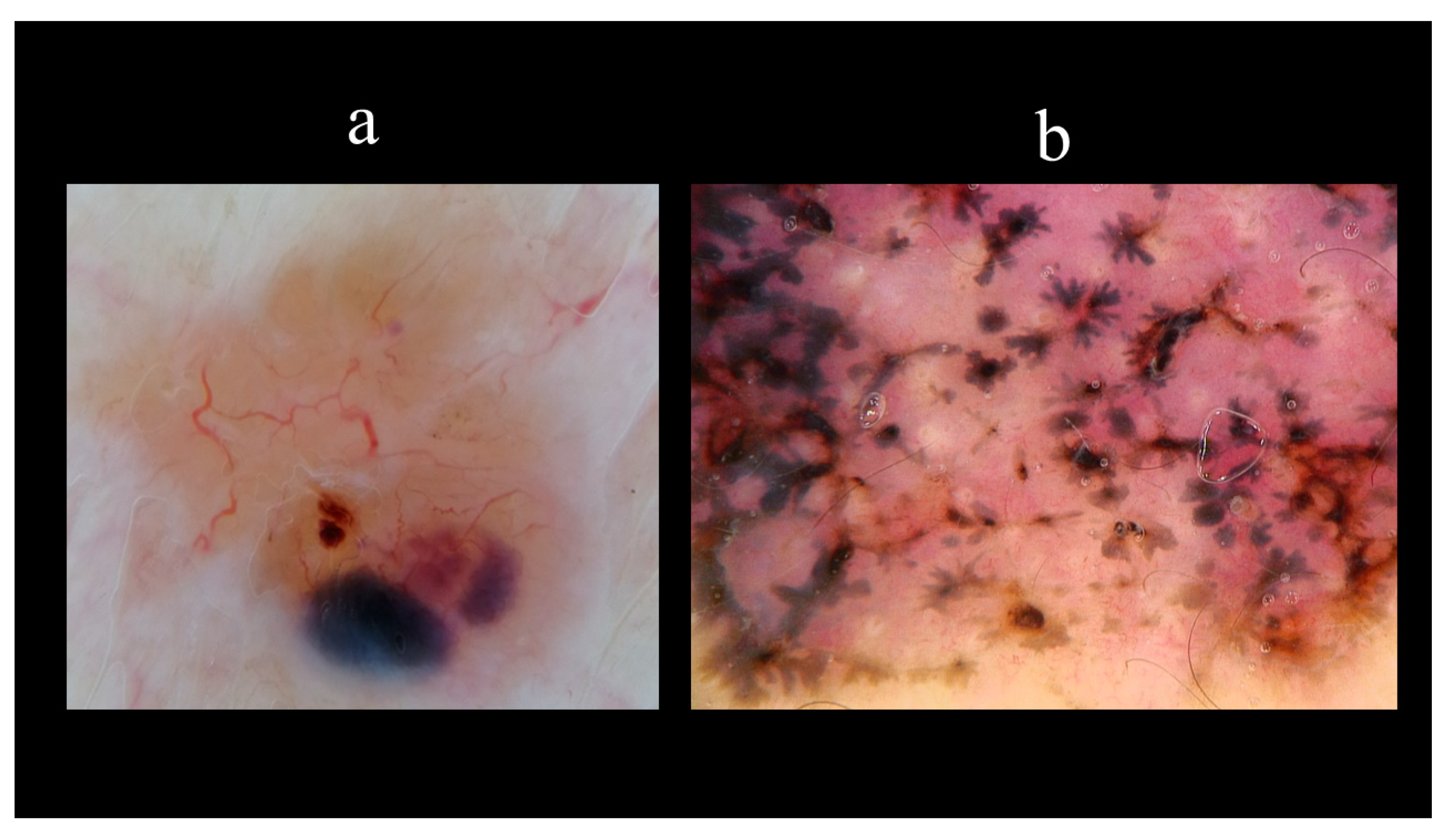Biomedicines 08 00449 g011