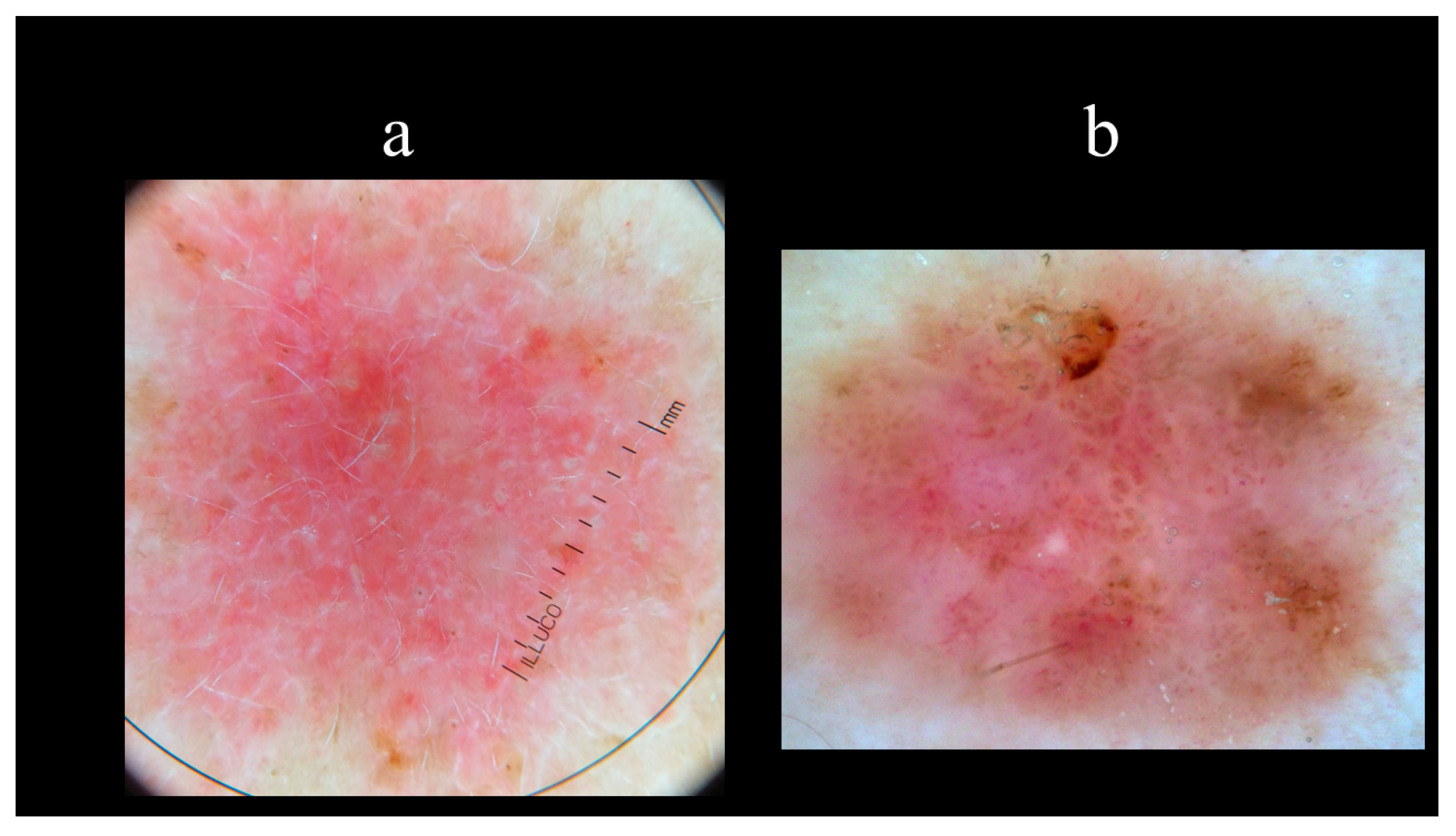 Biomedicines 08 00449 g013